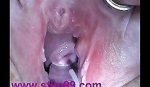 Spunk Control belongings in the air Injection needle about Cervix Utherus tick Bonking